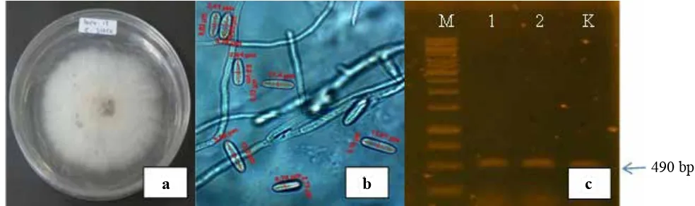Gambar 1. (a) Koloni C. acutatum pada media PDA, (b) konidia C. acutatum (perbesaran 1.000x), (c)  elektroforesis DNA C