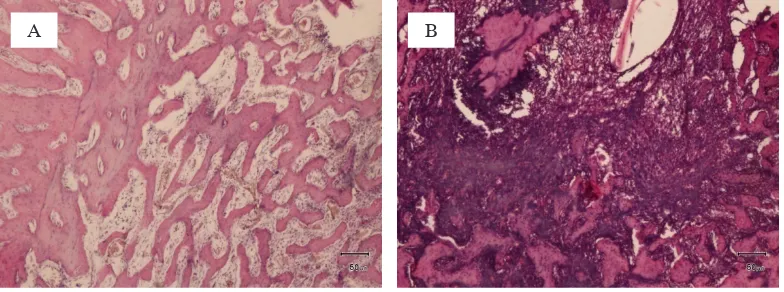 figure 3. Histological section of healing socket 30 days after ekstraction with HE staining