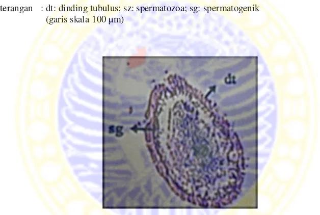 Gambar 3. Histologi gonad Phyllophorus sp. jantan fase pemulihan (recovery) 