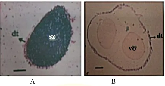 Gambar 6. Histologi gonad Phyllophorus sp. jantan (A) dan betina (B) pada fase 