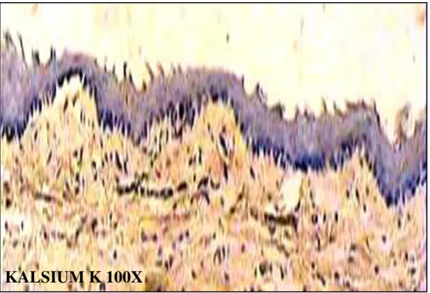 Gambar 5.18 :  Gambaran ekpresi kalsium intrasel pada biopsi gingiva mencit (kontrol) dengan pulasan metode immunohistokimia 