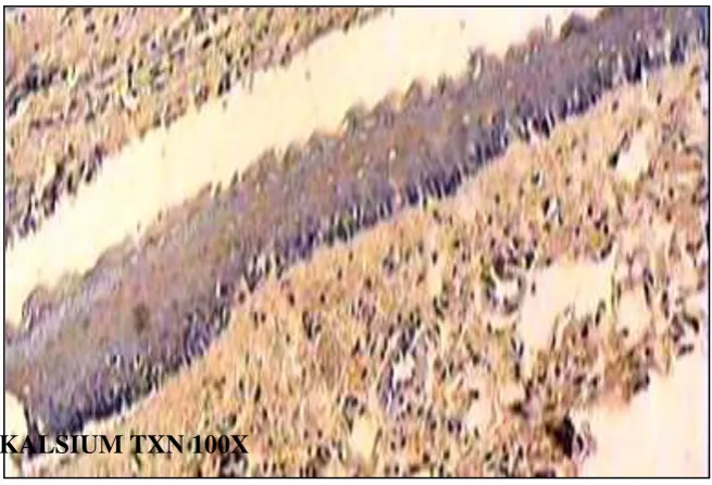 Gambar 5.20 :  Gambaran ekpresi kalsium intrasel pada biopsi gingiva mencit (toksin) dengan pulasan metode immunohistokimia 