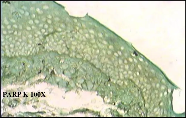 Gambar 5.24 :  Gambaran ekpresi PARP-1 pada biopsi gingiva mencit (kontrol) 