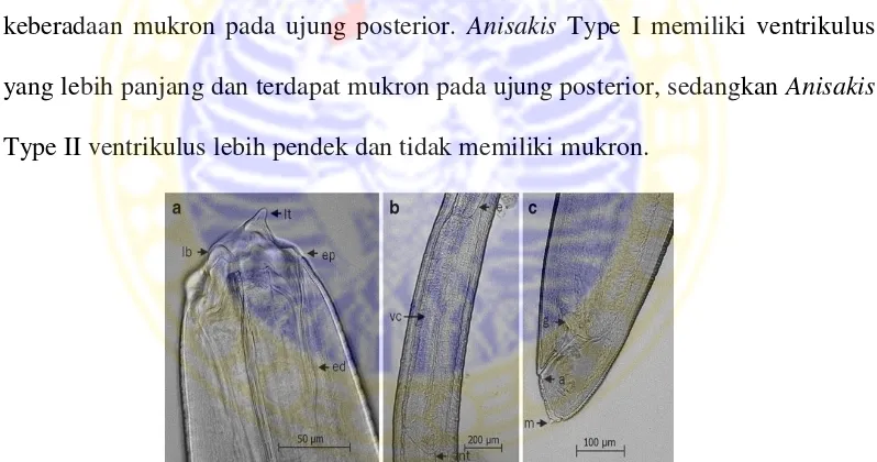 Gambar 2.2. Morfologi struktur tubuh Anisakis simplex c.dengan skala bar 100 µm. (a) bagian kepala ; terdapat beberapa bagian, yaitu (lt) larval tooth : gigi larva, (ep) excretory pore : pori-pori/lubang pengeluaran, (ed) excretory duct : saluran pengeluar