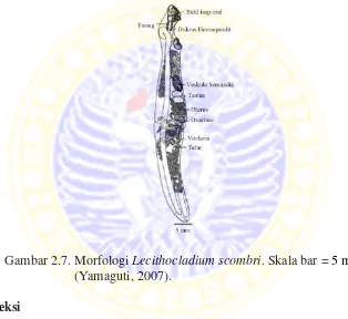 Gambar 2.7. Morfologi Lecithocladium scombri. Skala bar = 5 mm  