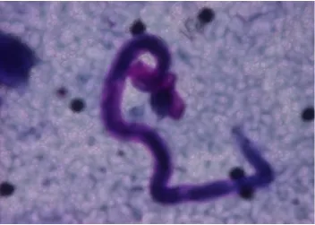 Figure 1.Microfilariae in a Patient Blood.