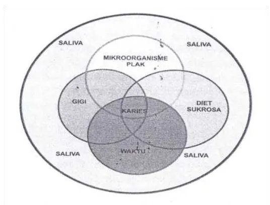 Gambar 5. Faktor terjadinya karies (Putri dkk, 2011)