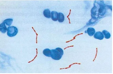 Gambar 2.1  Morfologi M. TuberculosisSumber : Depkes RI, 2006.  dengan pewarnaan Ziehl Neelsen  