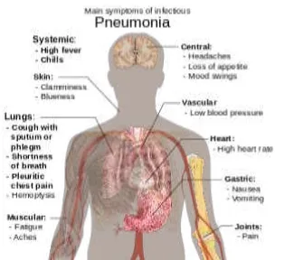 Gambar 2.2 Pneumonia (CDC, 2009) 