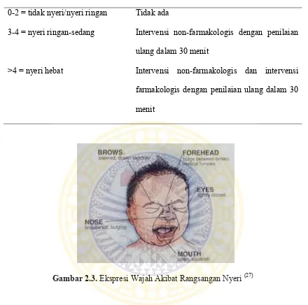 Gambar 2.3. Ekspresi Wajah Akibat Rangsangan Nyeri (27)  