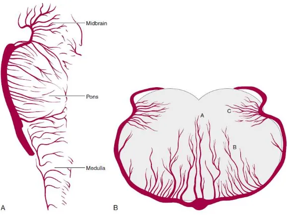 Gambar 3.3. Arteri perforator pada pons. Kiri: Potongan Lateral. Kanan: Potongan aksial