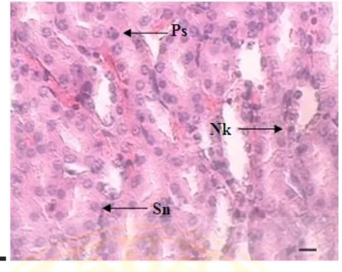 Gambar 4.4 Gambaran mikroskopis ginjal mencit yang mengalami kerusakan 