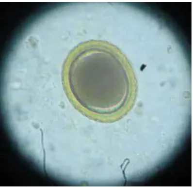 Gambar 2.2.  Telur cacing Toxocara vitulorum pada pemeriksaan feses secara mikroskopis