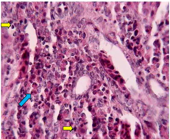 Gambar 2.5. Panah biru (      ) menunjukkan eosinofil dan panah kuning (     ) menunjukkan limfosit pada area portal hepar ayam penderita toxocariasis pada hari ke-21 pasca infeksi