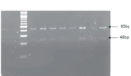 Figure 4. Restriction with Mva at the codon 12 PCR product 