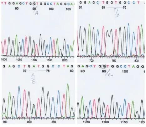 Figure 5. Part sequence of the mutant type of KRAS gene at GGT>GCT, GGT>GGA, GGT>GAT 