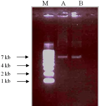 Figure 2 . Electrophoresis PCR product analysis on erythrocyte genomic DNA of mice. A= Mice infected with Plasmodium berghei, B= Uninfected mice (column B), M= Marker 