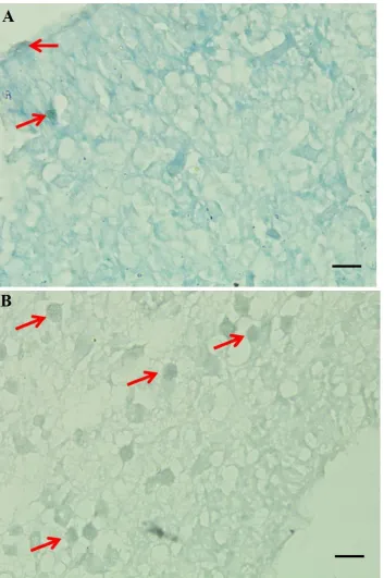 Figure 2 . Mice brain ventricle with TUNEL Assay staining with 1000x magnification. A= Control, B= T