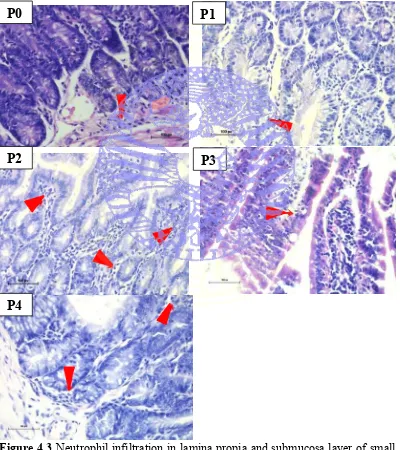 Figure 4.3  Neutrophil infiltration in lamina propia and submucosa layer of small intestine