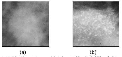 Gambar 2.5 (a) Citra Massa, (b) Citra Mikrokalsifikasi (Santoso, 2008) 