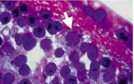 Gambar 2.3 B 2.3 Bradizoid Toxoplasma gondii di dalam kista j(panah)(Tabbara, 2014)sta jaringan