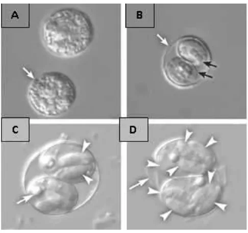 Gambar 2.4 Ookista Toxoplasma gondiiOokista bersporulasi, dinding ookista (panah putih) dan dinding sporokista (panahhitam)