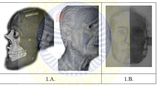Gambar 1. Contoh rekonstruksi wajah dari tengkorak tidak beridentitas. Gambar 1A: rekonstruksi 3D (patung wajah dan kepala); di bagian dalam adalah tengkorak individu tersebut, yang diberi lapisan jaringan kulit wajah dari bahan khusus (“clay”)