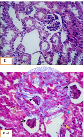 Gambar 4.1 Histopatologi glomerulus dan tubulus ginjal mencit (K-) pelarut obat 0,5 ml/ekor tanpa dipapar asap rokok; (k+1) pelarut obat 0,5 ml/ekor + papar asap rokok