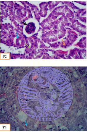 Gambar 4.3 Histopatologis glomerulus dan tubulus ginjal mencit (P2) dipapar 