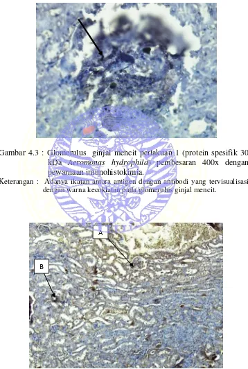 Gambar 4.3 : Glomerulus  ginjal mencit perlakuan 1 (protein spesifik 30 