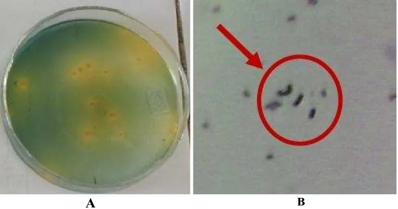 Gambar 1. (A) Foto koloni V. cholerae berwarna kuning pada media TCBS, (B) Struktur mikroskopis bakteri V