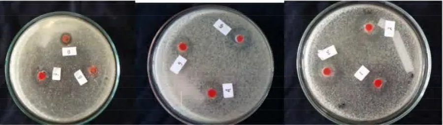 Gambar 2. Uji Antagonistik koloni Streptomyces sp.1 sampai dengan Streptomyces sp9. dengan Ralstonia    solanacearum