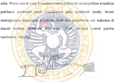 Gambar 2.6 Metode tapotement claping (Sumber: Bambang Priyonoadi, 2008) 