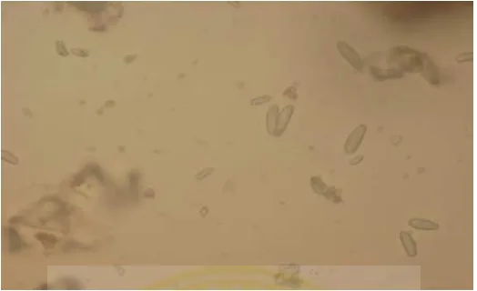 Gambar 5.14 korteks dengan butir amilum berbentuk lonjong danbulat telur pada pengamatan dengan mikroskop perbesaran 400xdalam media air.