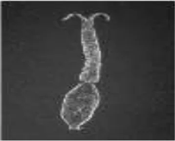 Gambar 2.2 Telur cacing Schistosoma japonicum.