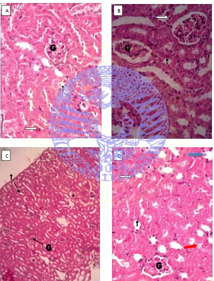 Figure 4.1.      A, B, D ( T0, T2, T4, 400x magnification), C (T3, 100x magnification)  Figures shows histological view of mice that used in the research, (        ) shows pycnotic, (             ) shows Cellular cast, (          ) shows Protein cast, (G) shows  Kidney Histology using HE staining glomerulus, and (T) shows Tubulus 