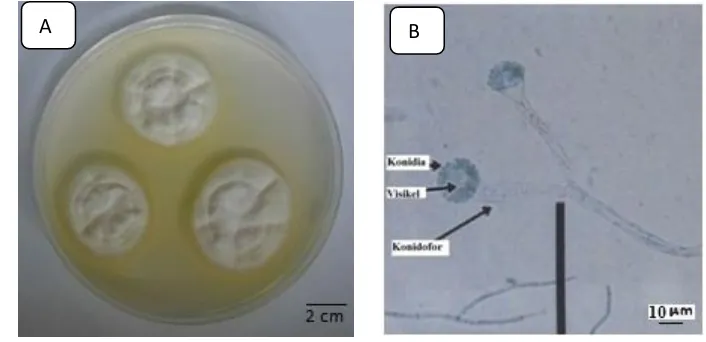 Gambar 2.4 Koloni Aspergillus candidus (A), Morfologi Aspergillus candidus (B)Sumber: Safika, (2008)   