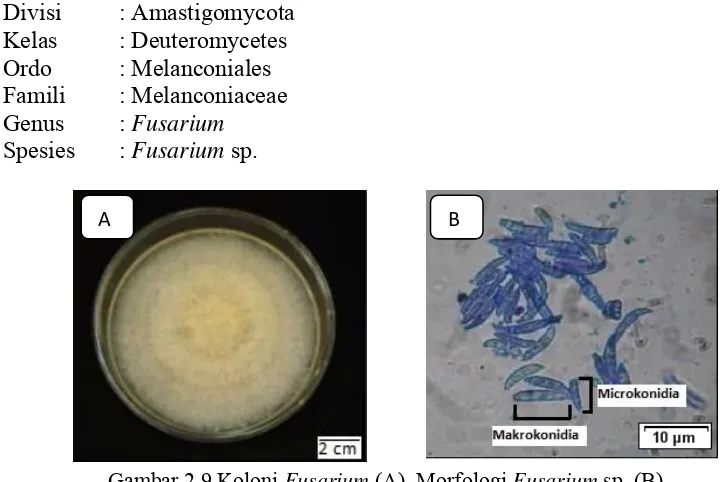 Gambar 2.9 Koloni Fusarium (A), Morfologi Fusarium sp. (B) Sumber : Fausi dkk., (2009)  