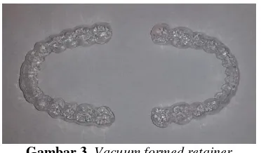 Gambar 3. Vacuum formed retainer 