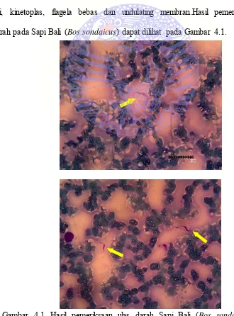 Gambar 4.1 Hasil pemeriksaan ulas darah Sapi Bali (Bos sondaicus) pada perbesaran 1000x terlihat adanya Trypanosoma sp.pada plasma darah
