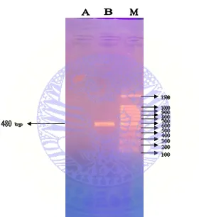 Gambar 4.2 Hasil Elektroforesis PCR pada darahSapi Bali (Bos sondaicus). A. Darah Sapi Bali (Bos sondaicus) negatif; 