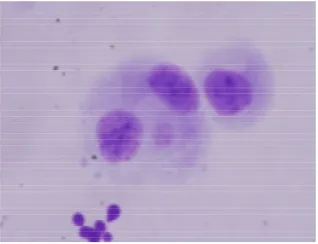 Figure 2. Micronuclei (small round shape besides binucleated cells in cytoplasm) induced by 0.5 Gy of gamma rays and treated with ginseng of 100 µg/ML 3 hour post irradiation