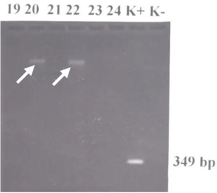 Gambar 2. Hasil analisis PCR untuk gen antigen base-pairspecies-specific (produk berukuran 209 ) pada sampel nomor 10 dan 15 (MIU positif) dan 1, 2, 7-9, 11-14 (MIU negatif)