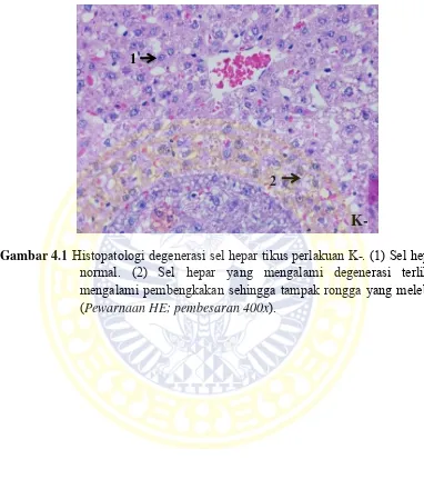 Gambar 4.1 Histopatologi degenerasi sel hepar tikus perlakuan K-. (1) Sel hepar 