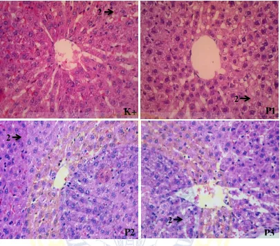 Gambar 4.2 Histopatologi degenerasi sel hepar tikus perlakuan K+, P1, P2, P3. (2) Sel hepar yang mengalami degenerasi terlihat mengalami pembengkakan sehingga tampak rongga yang melebar (Pewarnaan HE; pembesaran 400x)