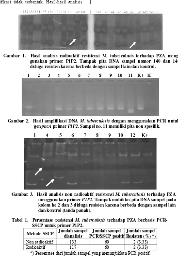 Gambar 2.  Hasil amplifikasi DNA M. tuberculosis dengan menggunakan PCR untuk 