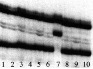 Gambar 3. Salah satu contoh hasil pendeteksian mutasi gen suatu mikroorganisme dengan teknik SSCP menggunakan DNA berlabel 32P radioaktif dimana untuk sampel nomor 7 mengalami perubahan migrasi pita DNA yang berbeda dengan lainnya.