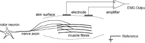 Gambar 3.1Bipolar electrode configuration[12]