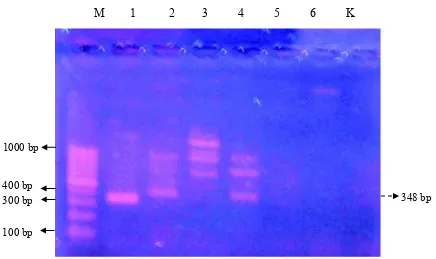 Gambar 2.  Deteksi gen stx-1 dengan primer LP30 dan LP 31 pada agarose 1 %. Lajur 1 kontrol positif: ATCC 43894; lajur 2: isolat FSKS 5 Pecatu; lajur 3: isolat FSKS 17 Kutuh; lajur 4: isolat FSKS 35 Ungasan; lajur 5: isolat FSKS 44 Ungasan; dan lajur 6: is