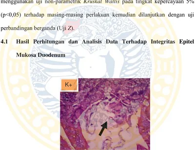 Gambar 4.1 Gambaran Histopatologi Duodenum pada  Kontrol Positif (K+) 